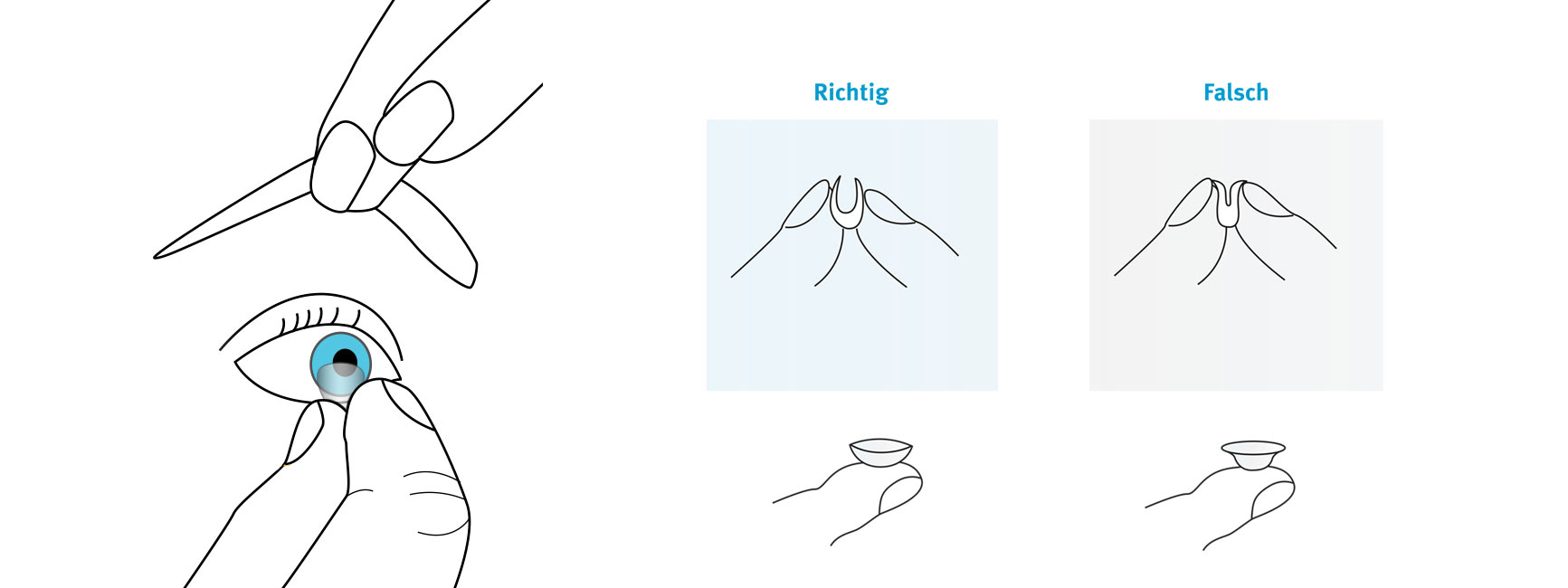 Illustration zur Handhabung von Kontaktlinsen